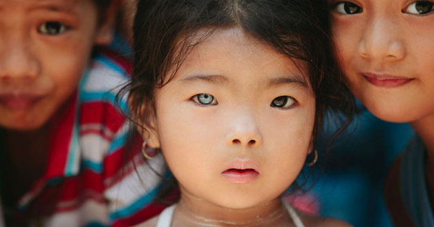 Child with heterochromia