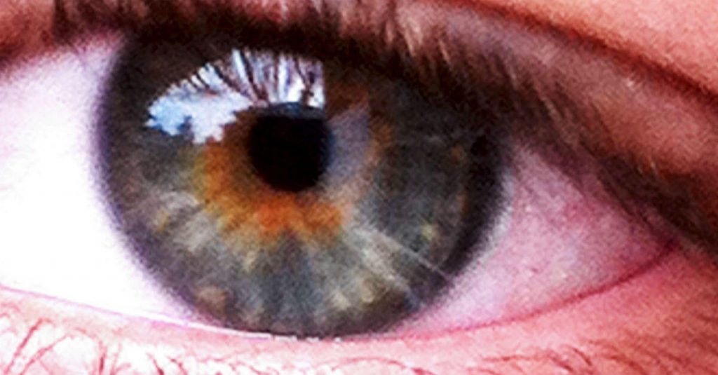 5 Rare Eye Conditions and How They Occur Bard Optical